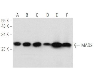 MAD2 Antibody (17D10) - Western Blotting - Image 354848 