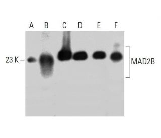MAD2B Antibody (14) - Western Blotting - Image 386078The Double Nickase Plasmid features a U6 promoter for sgRNA expression, a 20 nt targeting sequence, and a gRNA scaffold to guide Cas9n. It includes a CBh promoter for Cas9n (D10A) and puromycin resistance, GFP for transfection verification, and nuclear localization signals (NLS). The 2A peptide allows co-expression of Cas9n and Puro from a single promoter, enabling precise genome editing with reduced off-target effects.