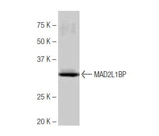 MAD2L1BP Antibody (4-RE23) - Western Blotting - Image 64992 