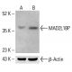 MAD2L1BP Antibody (4-RE23) - Western Blotting - Image 412846