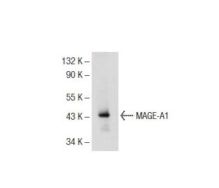 MAGE-A1 Antibody (3F256) - Western Blotting - Image 72567 