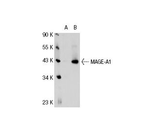 MAGE-A1 Antibody (MA454) - Western Blotting - Image 31796 