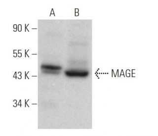 MAGE Antibody (5G152) - Western Blotting - Image 371598 