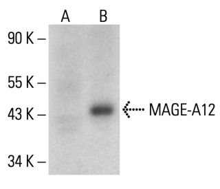 MAGE Antibody (F-1) - Western Blotting - Image 312004