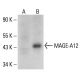 MAGE Antibody (F-1) - Western Blotting - Image 312004