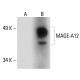 MAGE Antibody (F-4) - Western Blotting - Image 288575 