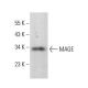 MAGE Antibody (F-4) - Western Blotting - Image 383057