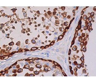MAGE-C1 Antibody (CT7-33) - Immunohistochemistry - Image 369178 