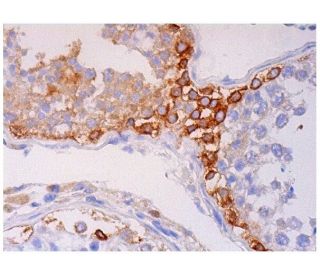MAGE-C1 Antibody (E-5) - Immunohistochemistry - Image 293702 