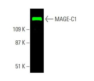 MAGE-C1 Antibody (CT7-33) - Western Blotting - Image 385430 
