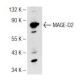 MAGE-D2 Antibody (FW.6) - Western Blotting - Image 126442