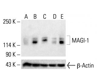 MAGI-1 Antibody (SS-5) - Western Blotting - Image 412737Each CRISPR/Cas9 Knockout (KO) Plasmid product consists of a pool of 3 plasmids designed to ensure identification and cleavage of a specific gene for maximum knockout efficiency. Each plasmid encodes a unique 20 nt sequence derived from the GeCKO (v2) library.