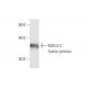 MAGI-2 Antibody (6F5) - Western Blotting - Image 349011 