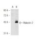 Makorin-2 Antibody (FG-9) - Western Blotting - Image 48819