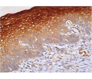 MAL Antibody (E-1) - Immunohistochemistry - Image 385594 