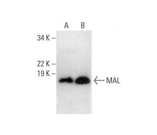 MAL Antibody (E-1) - Western Blotting - Image 289536The Double Nickase Plasmid features a U6 promoter for sgRNA expression, a 20 nt targeting sequence, and a gRNA scaffold to guide Cas9n. It includes a CBh promoter for Cas9n (D10A) and puromycin resistance, GFP for transfection verification, and nuclear localization signals (NLS). The 2A peptide allows co-expression of Cas9n and Puro from a single promoter, enabling precise genome editing with reduced off-target effects. 
