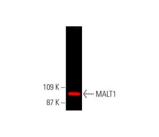 MALT1 Antibody (D-1) - Western Blotting - Image 381619Each CRISPR/Cas9 Knockout (KO) Plasmid product consists of a pool of 3 plasmids designed to ensure identification and cleavage of a specific gene for maximum knockout efficiency. Each plasmid encodes a unique 20 nt sequence derived from the GeCKO (v2) library.