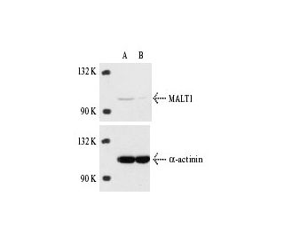 MALT1 siRNA (h): sc-35845. Western blot analysis of MALT1 expression in non-transfected control (A) and MALT1 siRNA transf 