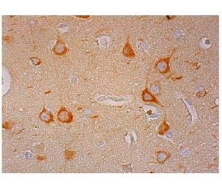 MAP-1B Antibody (AA6) - Immunohistochemistry - Image 299964
