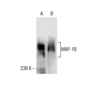 MAP-1B Antibody (AA9) - Western Blotting - Image 285079 
