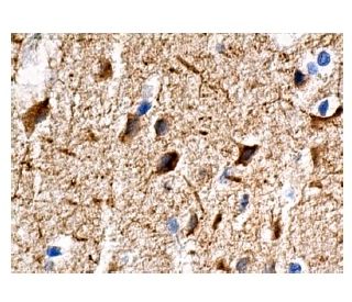 MAP-2 Antibody (A-8) - Immunohistochemistry - Image 157167 