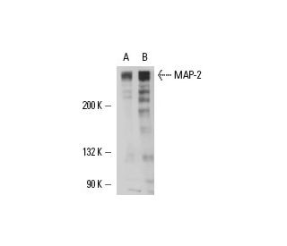 MAP-2 Antibody (AA5) - Western Blotting - Image 17049 