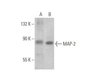 MAP-2 Antibody (AA6) - Western Blotting - Image 353291 