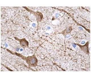 MAP-2 Antibody (AP20) - Immunohistochemistry - Image 156735 