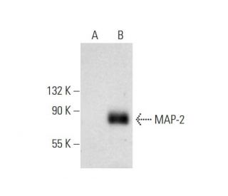 MAP-2 Antibody (C-2) - Western Blotting - Image 295954The Double Nickase Plasmid features a U6 promoter for sgRNA expression, a 20 nt targeting sequence, and a gRNA scaffold to guide Cas9n. It includes a CBh promoter for Cas9n (D10A) and puromycin resistance, GFP for transfection verification, and nuclear localization signals (NLS). The 2A peptide allows co-expression of Cas9n and Puro from a single promoter, enabling precise genome editing with reduced off-target effects.