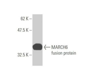 MARCH6 Antibody (1A5) - Western Blotting - Image 349021