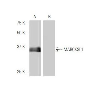 MARCKSL1 Antibody (K53) - Western Blotting - Image 54012SAM Transcription Activation: SAM system utilizing dCas9-VP64, MS2-P65-HSF1, and sgRNA for precise gene transcription activation.