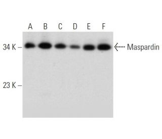 Maspardin Antibody (H-5) - Western Blotting - Image 320924 
