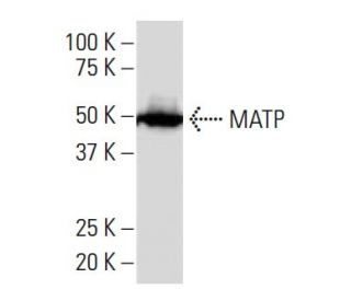 MATP Antibody (7K-2) - Western Blotting - Image 34155