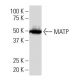 MATP Antibody (7K-2) - Western Blotting - Image 34155