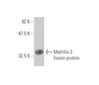 Matrilin-2 Antibody (2B8) - Western Blotting - Image 348540