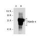 Matrilin-4 Antibody (B-1) - Western Blotting - Image 155008