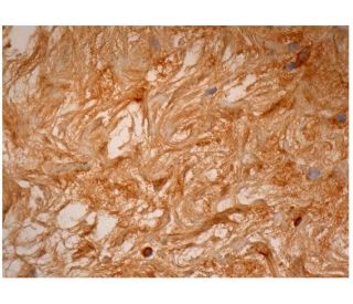 Matrilin-4 Antibody (F-2) - Immunohistochemistry - Image 287232 