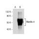 Matrilin-4 Antibody (F-2) - Western Blotting - Image 155010