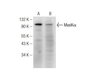 MaxiK&alpha; Antibody (B-1) - Western Blotting - Image 148996 