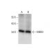 MBD3 Antibody (F-11) - Western Blotting - Image 72443