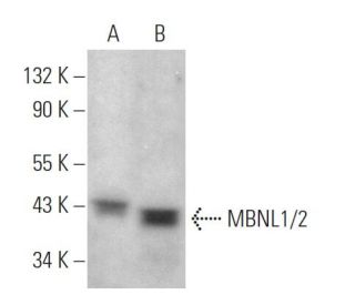 MBNL1/2 Antibody (5F9) - Western Blotting - Image 373596
