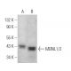 MBNL1/2 Antibody (5F9) - Western Blotting - Image 373596