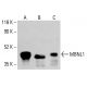 MBNL1 Antibody (4A8) - Western Blotting - Image 413441