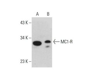 MC1-R Antibody (578CT6.2.3) - Western Blotting - Image 384290SAM Transcription Activation: SAM system utilizing dCas9-VP64, MS2-P65-HSF1, and sgRNA for precise gene transcription activation.