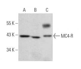 MC4-R Antibody (C-10) - Western Blotting - Image 368444The Double Nickase Plasmid features a U6 promoter for sgRNA expression, a 20 nt targeting sequence, and a gRNA scaffold to guide Cas9n. It includes a CBh promoter for Cas9n (D10A) and puromycin resistance, GFP for transfection verification, and nuclear localization signals (NLS). The 2A peptide allows co-expression of Cas9n and Puro from a single promoter, enabling precise genome editing with reduced off-target effects.