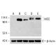Anticorpo MCC (A-9): sc-398216. Analisi Western blot dell'espressione di MCC in lisati cellulari totali di HeLa non trattati (A), HeLa trattati chimicamente (B, C, D) e HCT-116 (E). Reagente di rilevamento utilizzato: m-IgG1 BP-HRP: sc-525408. β-Actina (C4): sc-47778 utilizzata come controllo di caricamento. Reagente di rilevamento utilizzato: m-IgG Fc BP-HRP: sc-525409. MCC Antibody (A-9) - Western Blotting - Image 415411