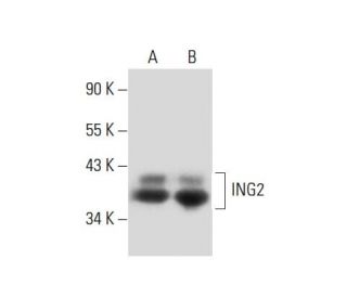 MCF7 + etopside Cell Lysate: sc-2281. Western blot analysis of...