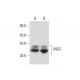 MCF7 + etopside Cell Lysate: sc-2281. Western blot analysis of...