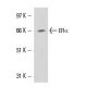 MCF7 nuclear extract: sc-2149. Western blot analysis of ER alpha expression...
