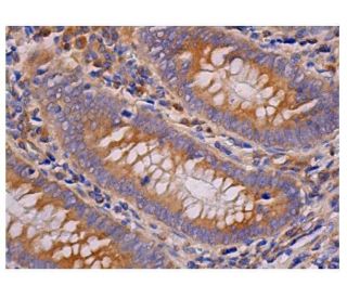 Mcl-1 Antibody (MCL-2601) - Immunohistochemistry - Image 348938 